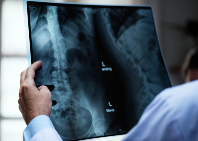 Como investir em equipamentos de radiologia traz mais segurança para sua clínica