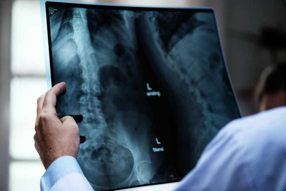 Como investir em equipamentos de radiologia traz mais segurança para sua clínica